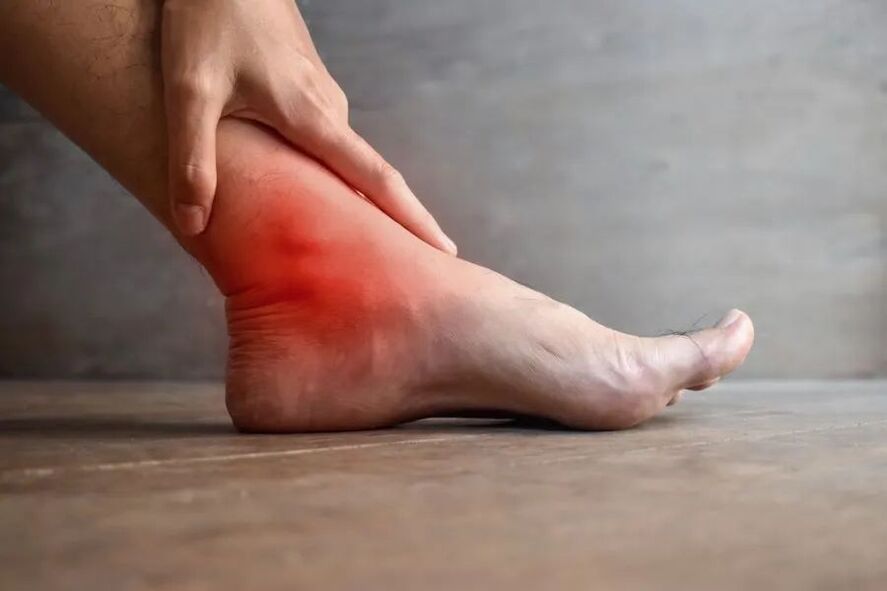 osteoarthritis of the ankle joint