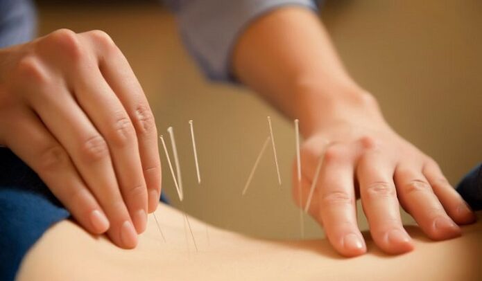 acupuncture to treat lower back pain